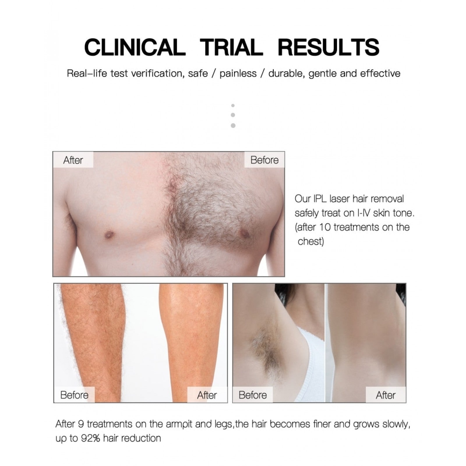 IPL Laser Hair Removal Mega Kuwait